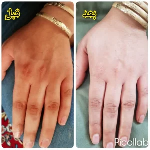 کرم جوانساز دست وپا گیاهی اصل
