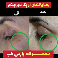 کرم دورچشم گیاهی اورجینال