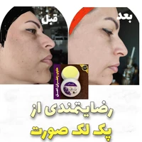 کرم ضدلک گیاهی اورجینال